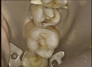 Composite_JPG.jpg