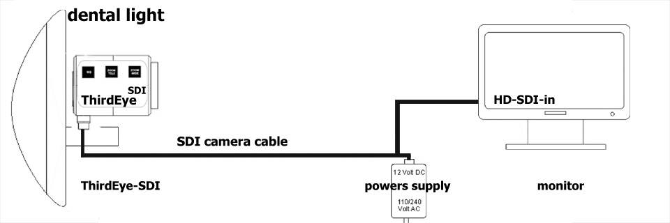 most-simple-configuration-of-thirdeye-sdi-dental-cameras