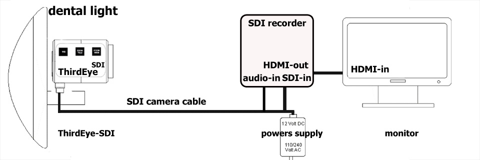 thirdeye-sdi-dental-camera using sdi-recorder with hdmi-out